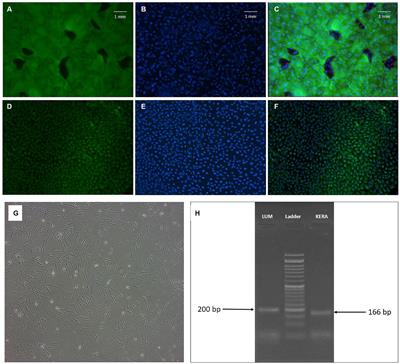 Effect of low dose honey on the apoptosis and inflammation gene expression in corneal limbal stem cells and keratocytes and its efficacy as an ophthalmic formulation in the treatment of dry eye: in-vitro and clinical study